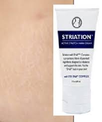 Striation Active Stretch Mark Cream 7.5% SNaP Complex