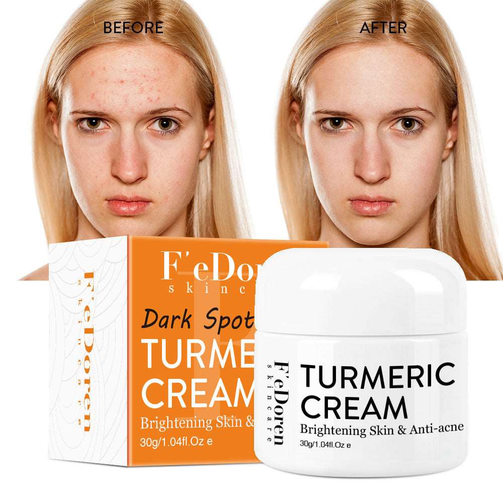 Turmeric Cream To Brighten Skin Tone and Reduce Acne